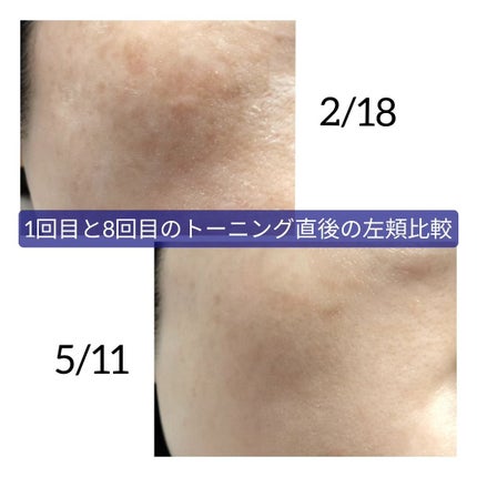 を使ったクチコミ(2枚目)