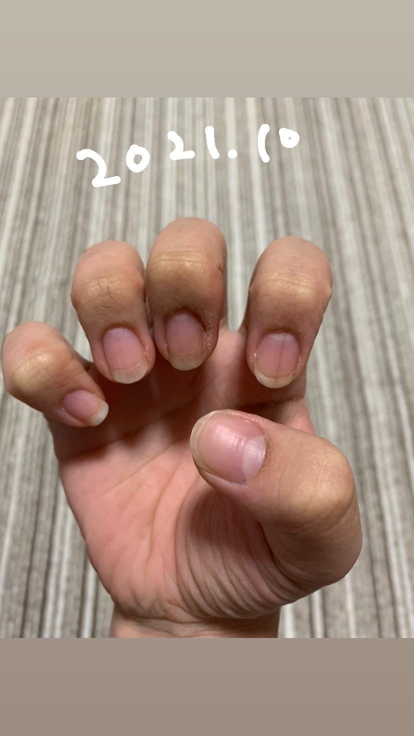 エテュセ クイックケアコート/ettusais/ネイルオイル・トリートメントを使ったクチコミ(6枚目)