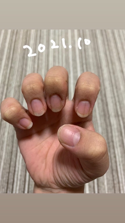 エテュセ クイックケアコート/ettusais/ネイルオイル・トリートメントを使ったクチコミ(6枚目)