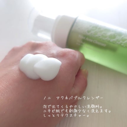 ザリアルノニアクネバブルクレンザー/celimax/泡洗顔を使ったクチコミ(3枚目)