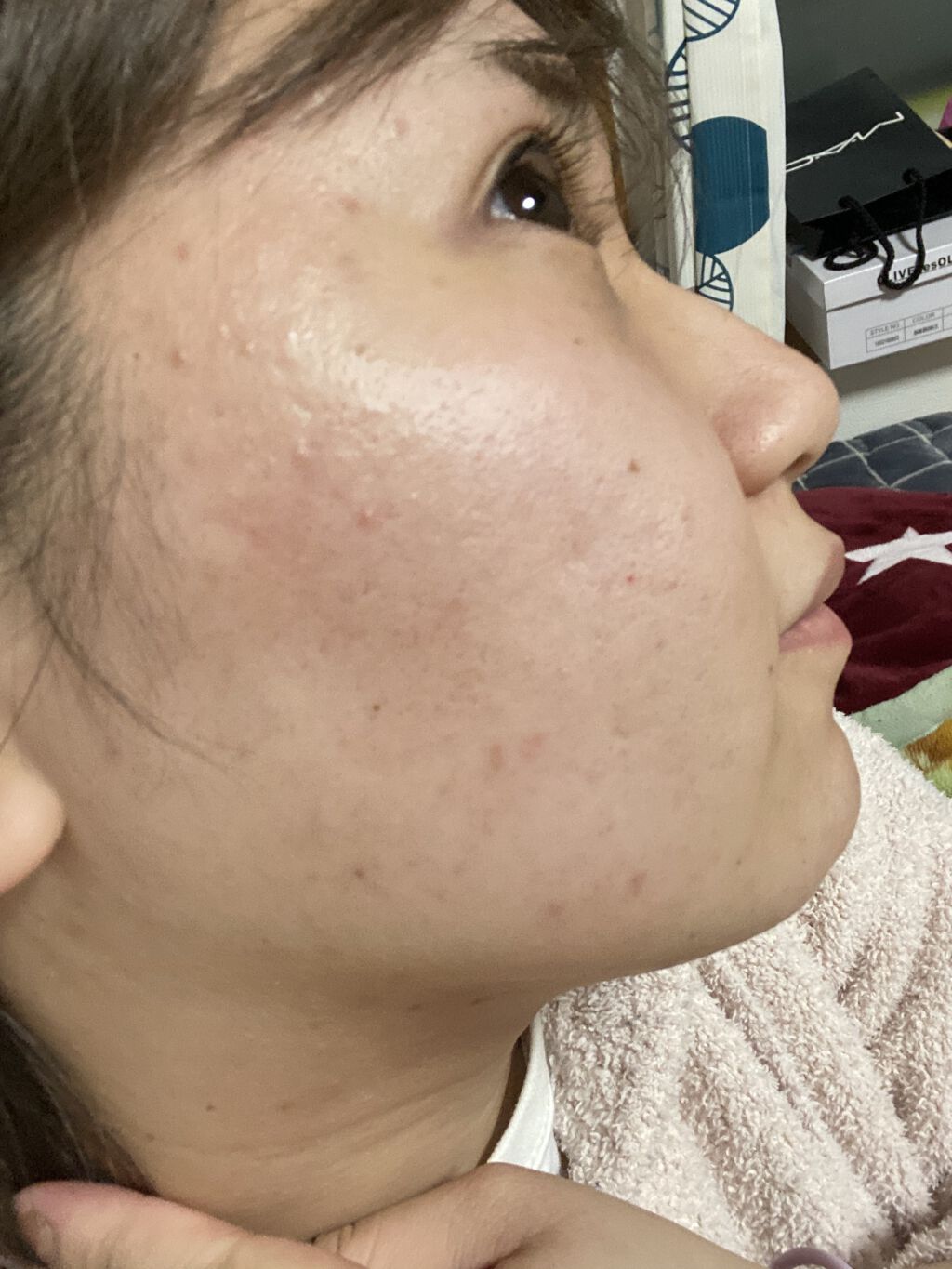 マデカソ CICAクリーム  /A’pieu/フェイスクリームを使ったクチコミ（2枚目）