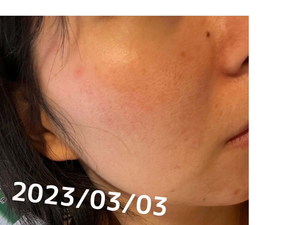 マジックカタツムリクリーム/ブラン/フェイスクリームを使ったクチコミ（3枚目）