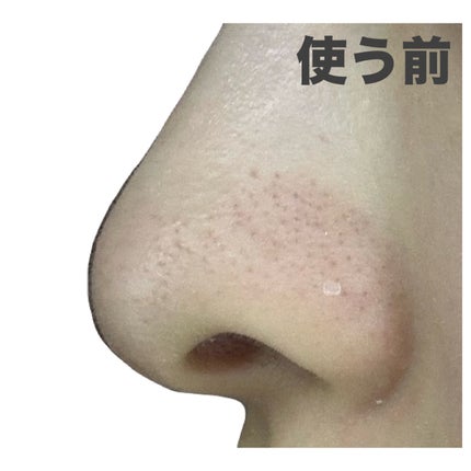 おうちdeエステ 肌をなめらかにするマッサージ洗顔ジェル 炭/ビオレ/その他洗顔料を使ったクチコミ(4枚目)