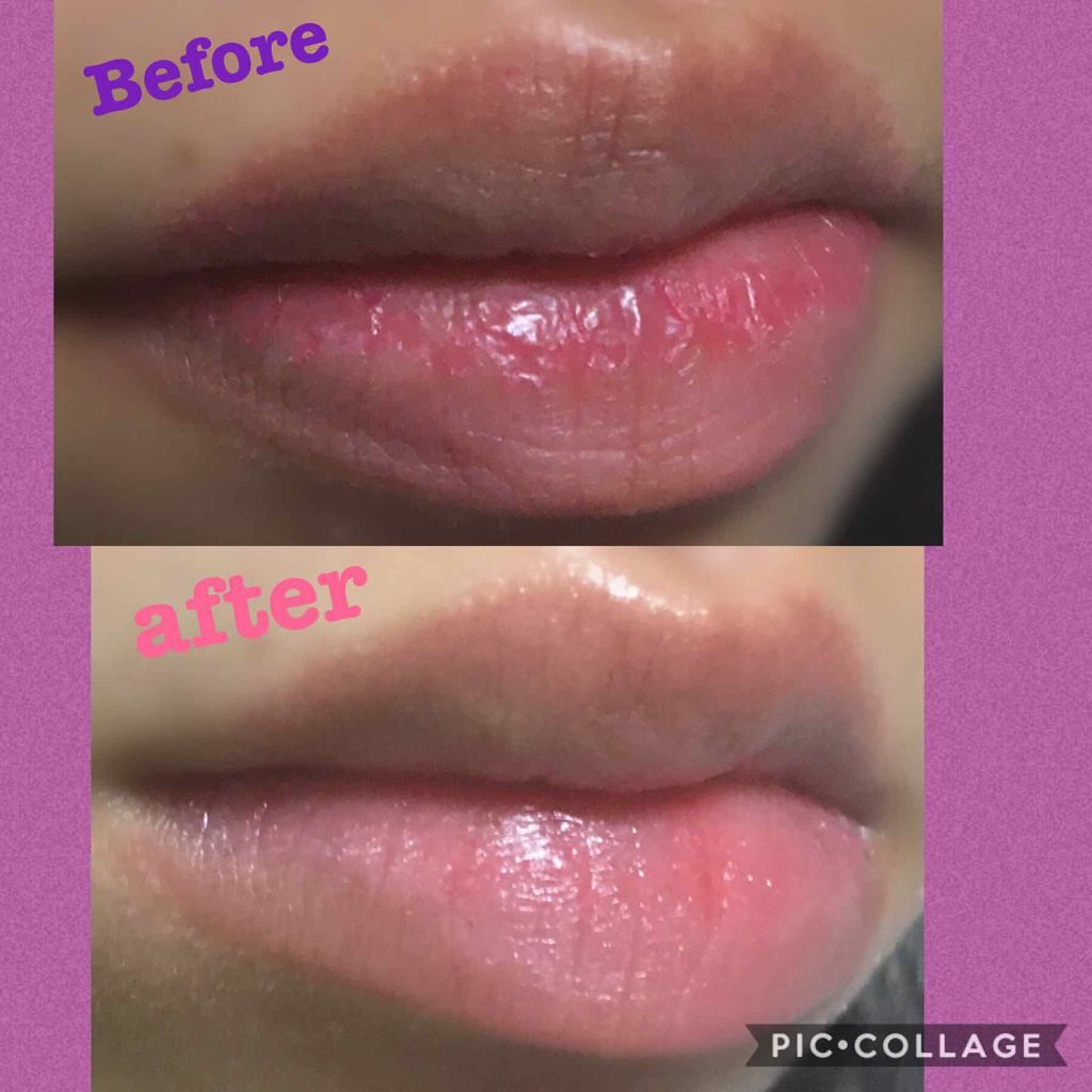 キス リップスクラブ/ラッシュ/リップスクラブを使ったクチコミ(3枚目)