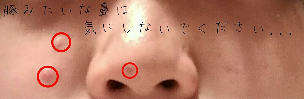 明色美顔水 薬用化粧水/美顔/化粧水を使ったクチコミ（2枚目）