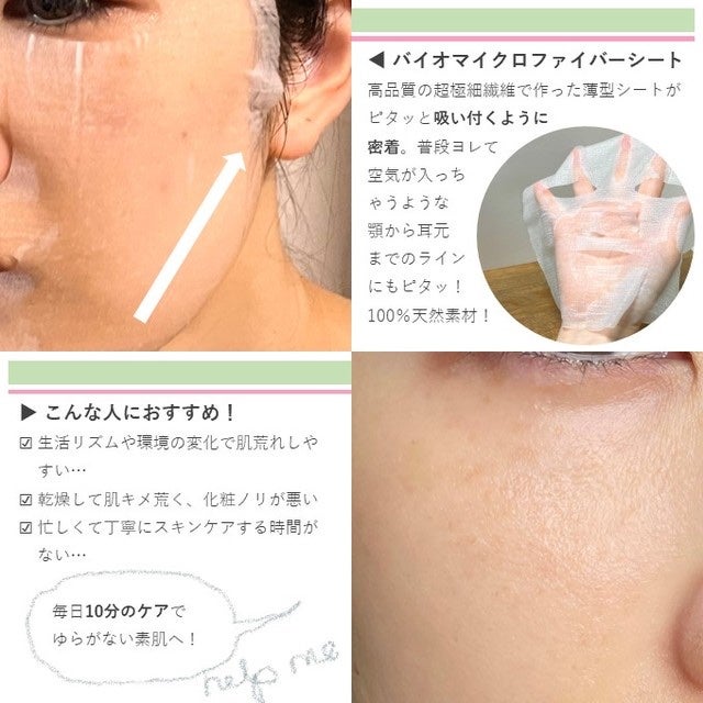 CICAリペア マスク/クリアターン/シートマスク・パックを使ったクチコミ(2枚目)