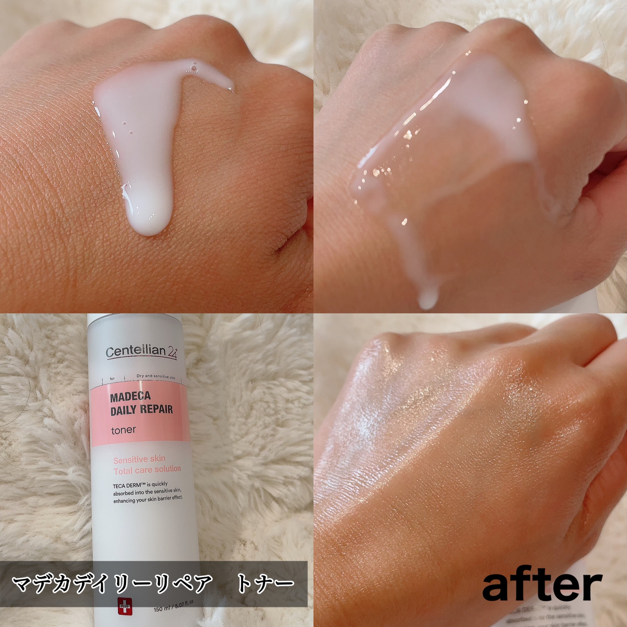 マデカデイリーリペアトナー/センテリアン24/化粧水を使ったクチコミ（2枚目）