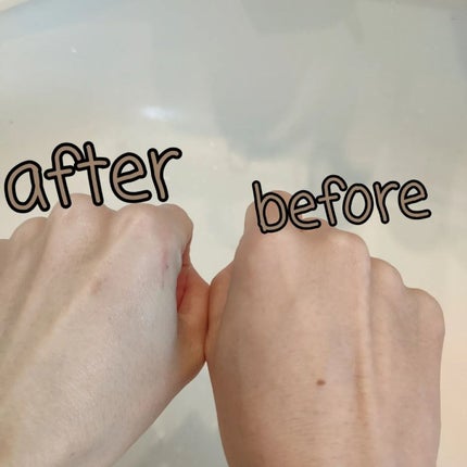 トラベルセット/BRIGHTAGE/トライアルキットを使ったクチコミ(2枚目)