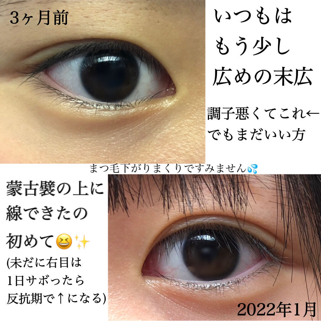 のびるアイテープ/セリア/二重まぶた用アイテムを使ったクチコミ（3枚目）