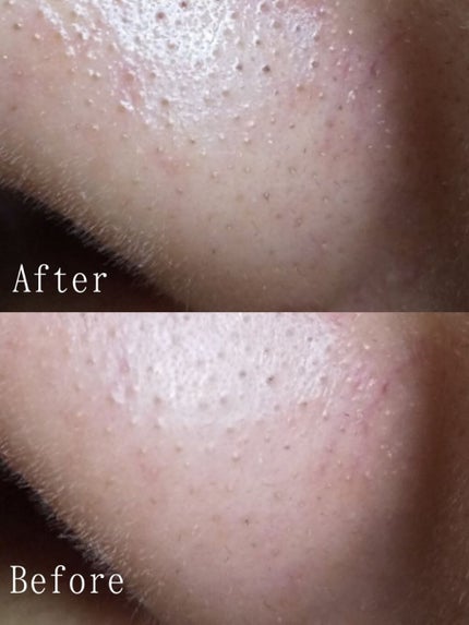 ピュア クレンジング オイル/manyo/オイルクレンジングを使ったクチコミ(4枚目)