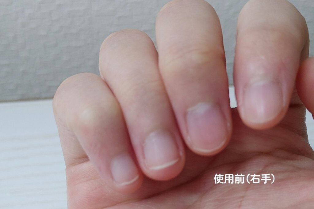 ネイルリラクシングオイル/デュカート/ネイルオイル・トリートメントを使ったクチコミ(6枚目)