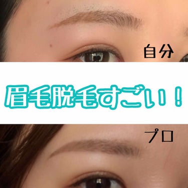 もっぷ on LIPS 「人生初の眉毛脱毛に行ってきました！！！👏🏻綺麗すぎて1日中自分..」（1枚目）