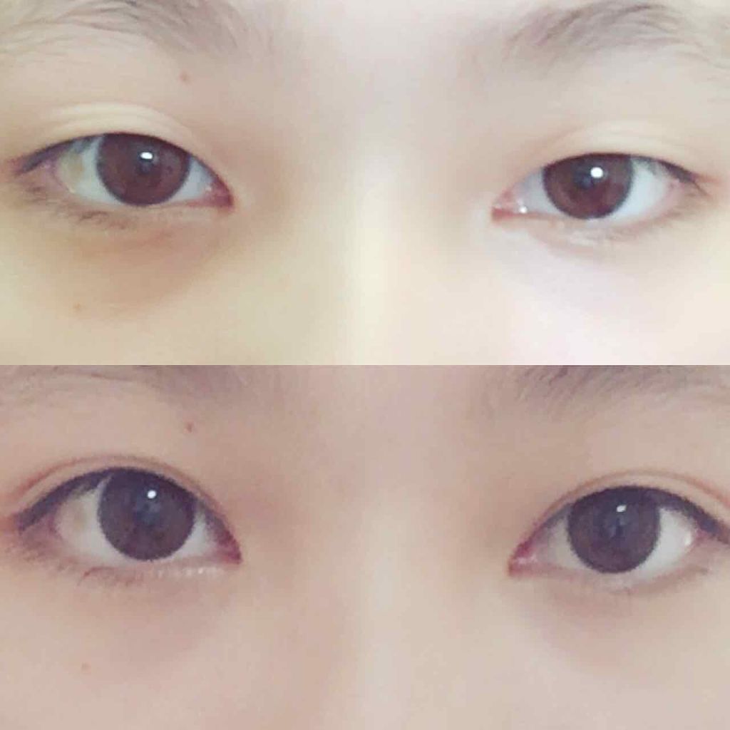 ナイトアイボーテ/StreeTrend/二重まぶた用アイテムを使ったクチコミ（1枚目）