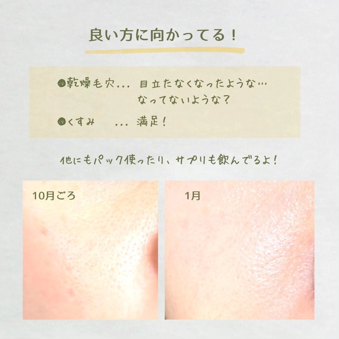 Cエッセンス VC5+PLUS /EBiS化粧品/美容液を使ったクチコミ(3枚目)