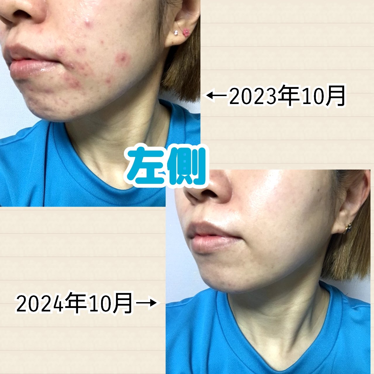 シルコット うるうるコットン/シルコット/コットンを使ったクチコミ（3枚目）