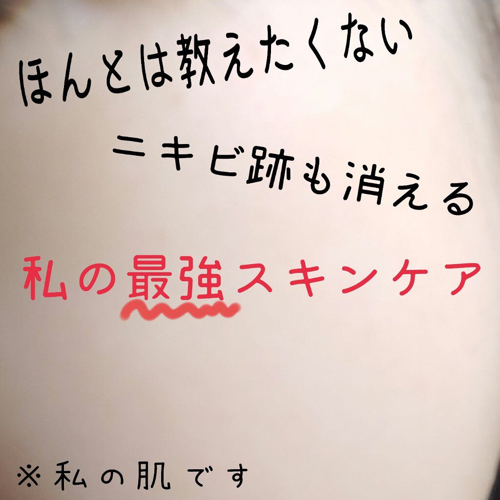 オリジナル ピュアスキンジェリー/ヴァセリン/ボディクリームを使ったクチコミ(1枚目)