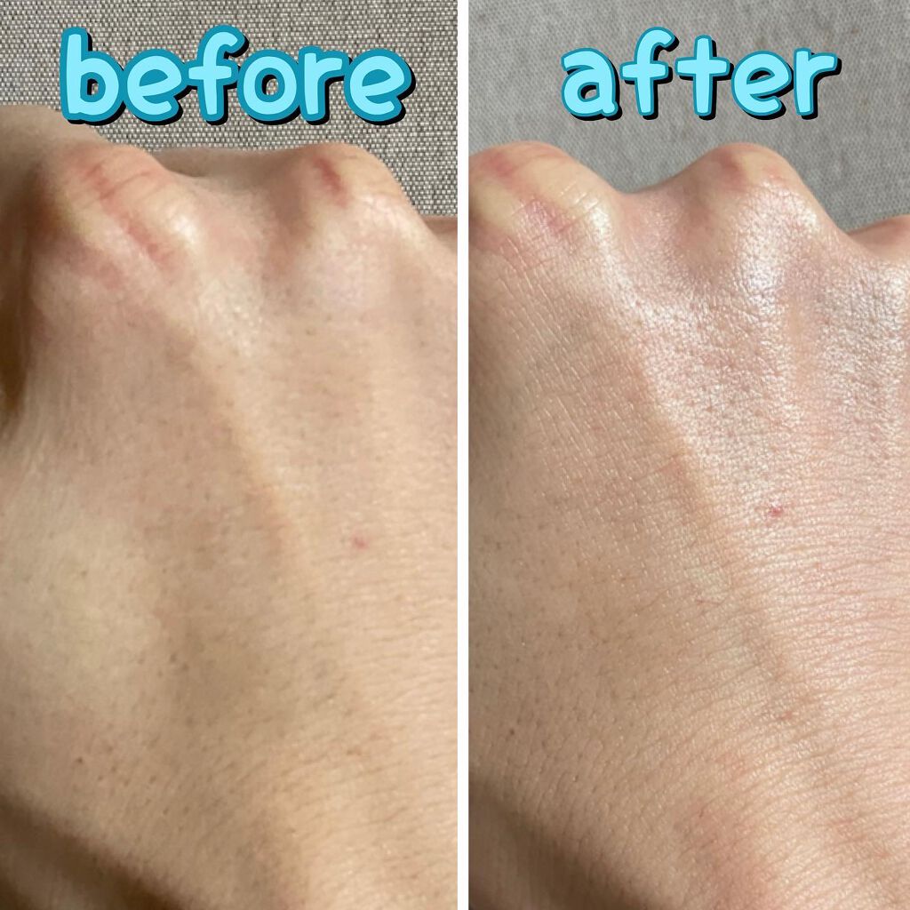 マイクロミストローション2.0/LOGIC/ミスト状化粧水を使ったクチコミ（3枚目）