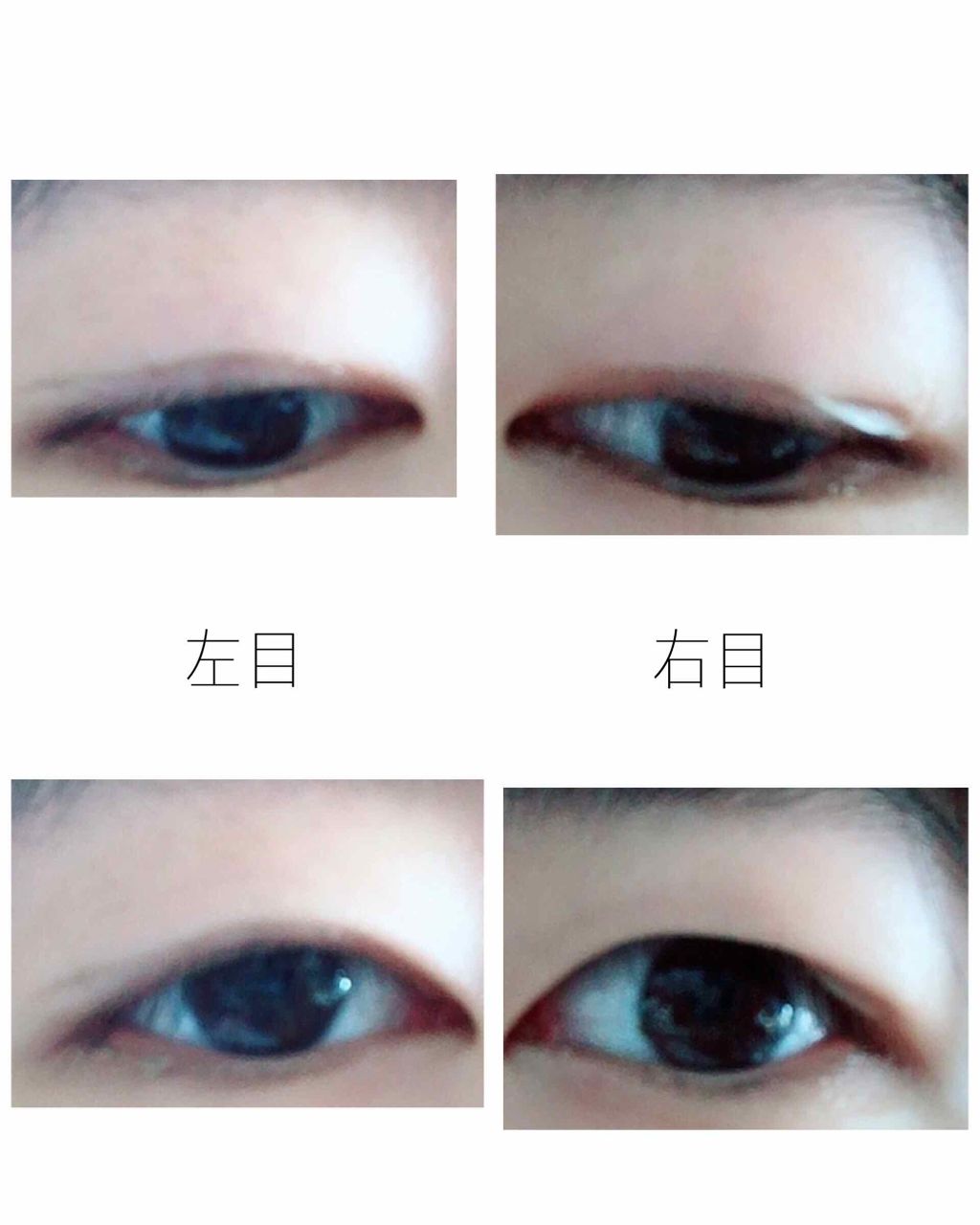 ヌード二重まぶたシール/DAISO/二重まぶた用アイテムを使ったクチコミ(2枚目)