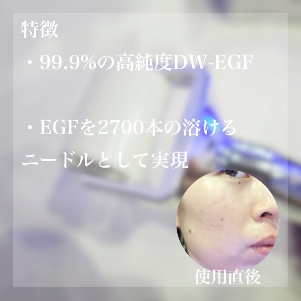 ダーマトックスニードルショット/Easydew/その他スキンケアを使ったクチコミ(2枚目)