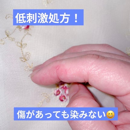 オリジナル ピュアスキンジェリー/ヴァセリン/ボディクリームを使ったクチコミ(5枚目)