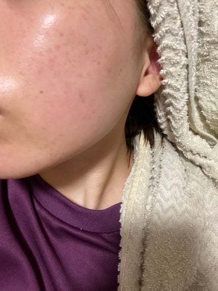 ホワイトニング ミスト セラム/アルージェ/ミスト状化粧水を使ったクチコミ(4枚目)