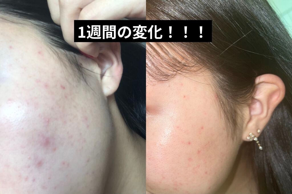 デュオ ザ クレンジングバーム ブラック/DUO/クレンジングバームを使ったクチコミ(3枚目)