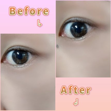 ジュエリアプレミアム マイクロパッチ/ジュエリアプレミアム/シートマスク・パックを使ったクチコミ(3枚目)