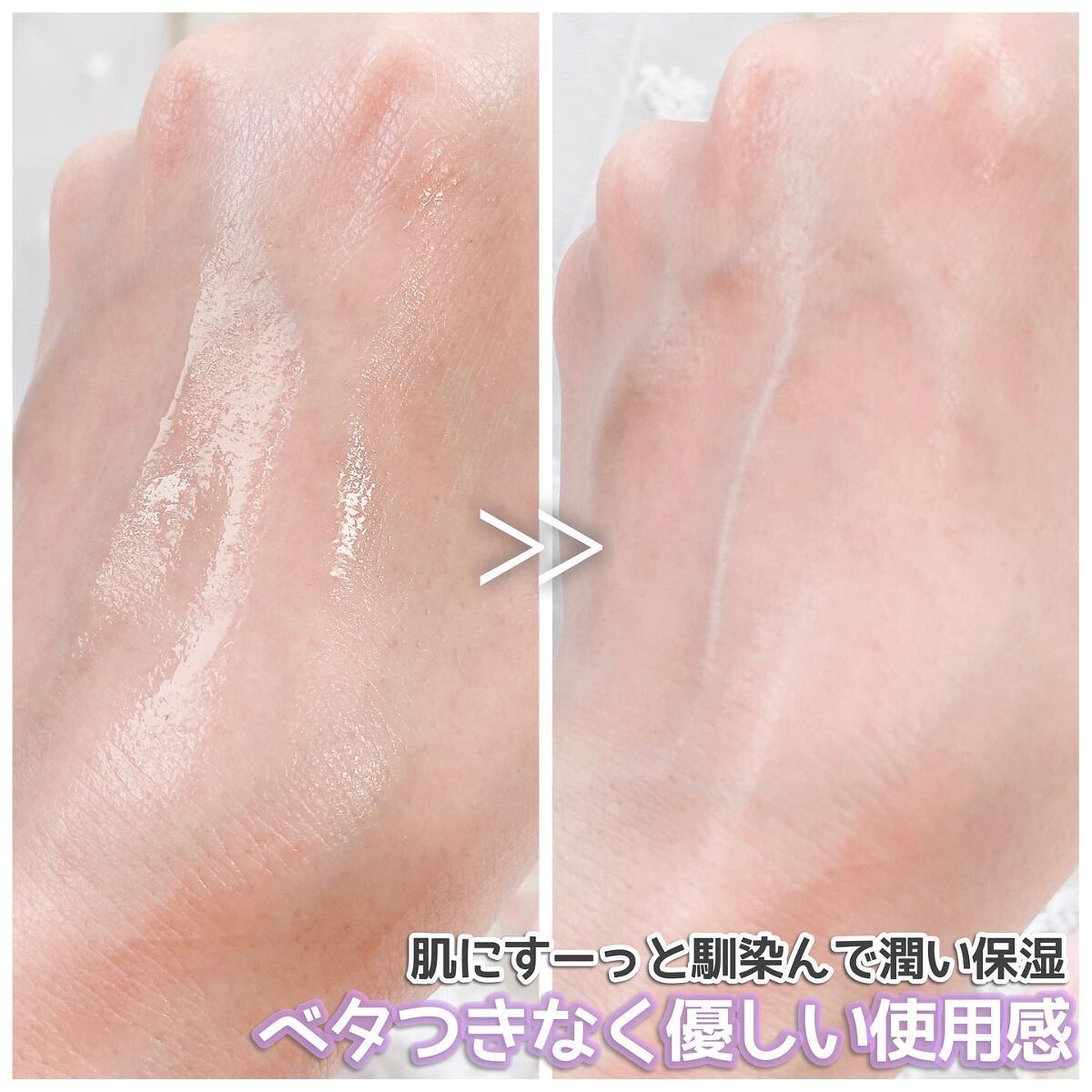 アカルミー化粧水/ワイズ/化粧水を使ったクチコミ(3枚目)