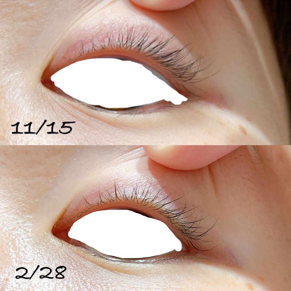 エクストラビューティ アイラッシュトニック/DHC/まつげ美容液を使ったクチコミ（2枚目）