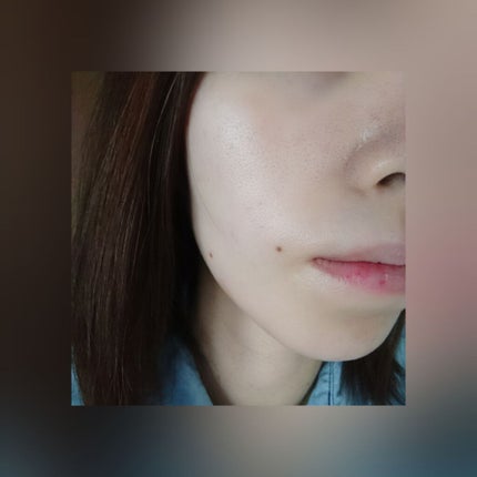 シーボン CHエッセンス MD/シーボン./美容液を使ったクチコミ(4枚目)