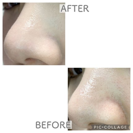 ピンクティーツリーカバークッション/APLIN/クッションファンデーションを使ったクチコミ(6枚目)