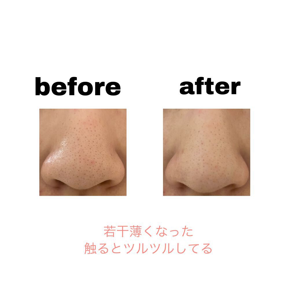 ノーモアブラックヘッド(ノーズピーリング)/One-day's you/スクラブ・ゴマージュを使ったクチコミ(2枚目)