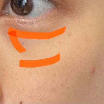 【旧】ディオールスキン フォーエヴァー スキン コレクト コンシーラー/Dior/リキッドコンシーラーを使ったクチコミ(2枚目)