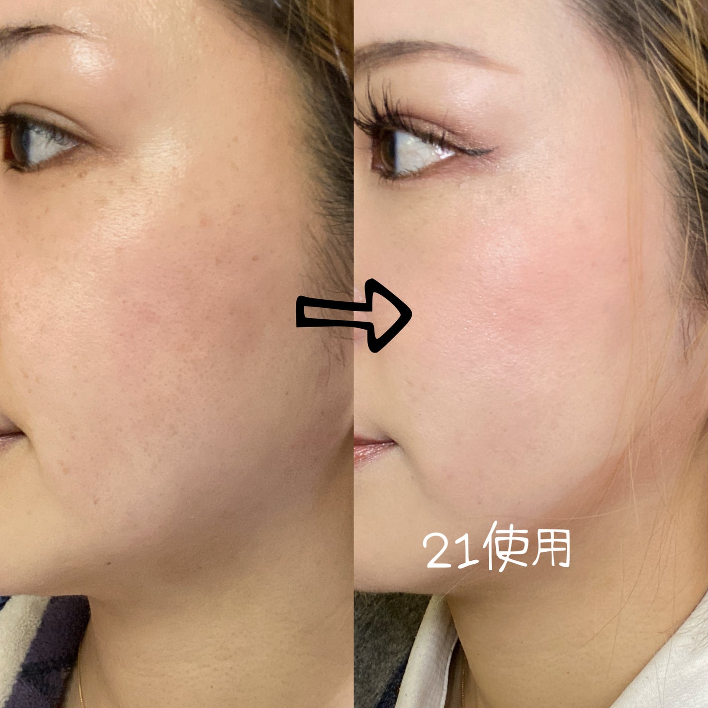 ブリージンググロークッション/Healus/クッションファンデーションを使ったクチコミ(6枚目)