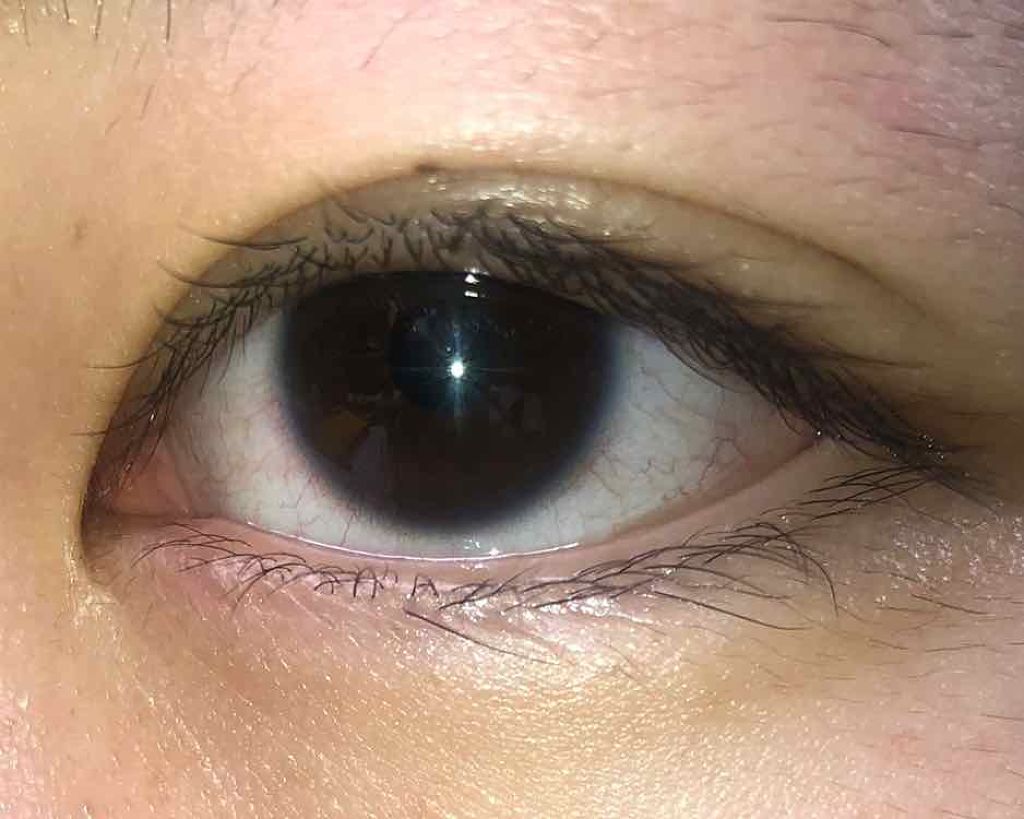 ミッシュ ブルーミン マンスリー (クォーターヴェール シリーズ/イノセント シリーズ)/ミッシュブルーミン/1ヶ月(1MONTH)カラコンを使ったクチコミ(3枚目)