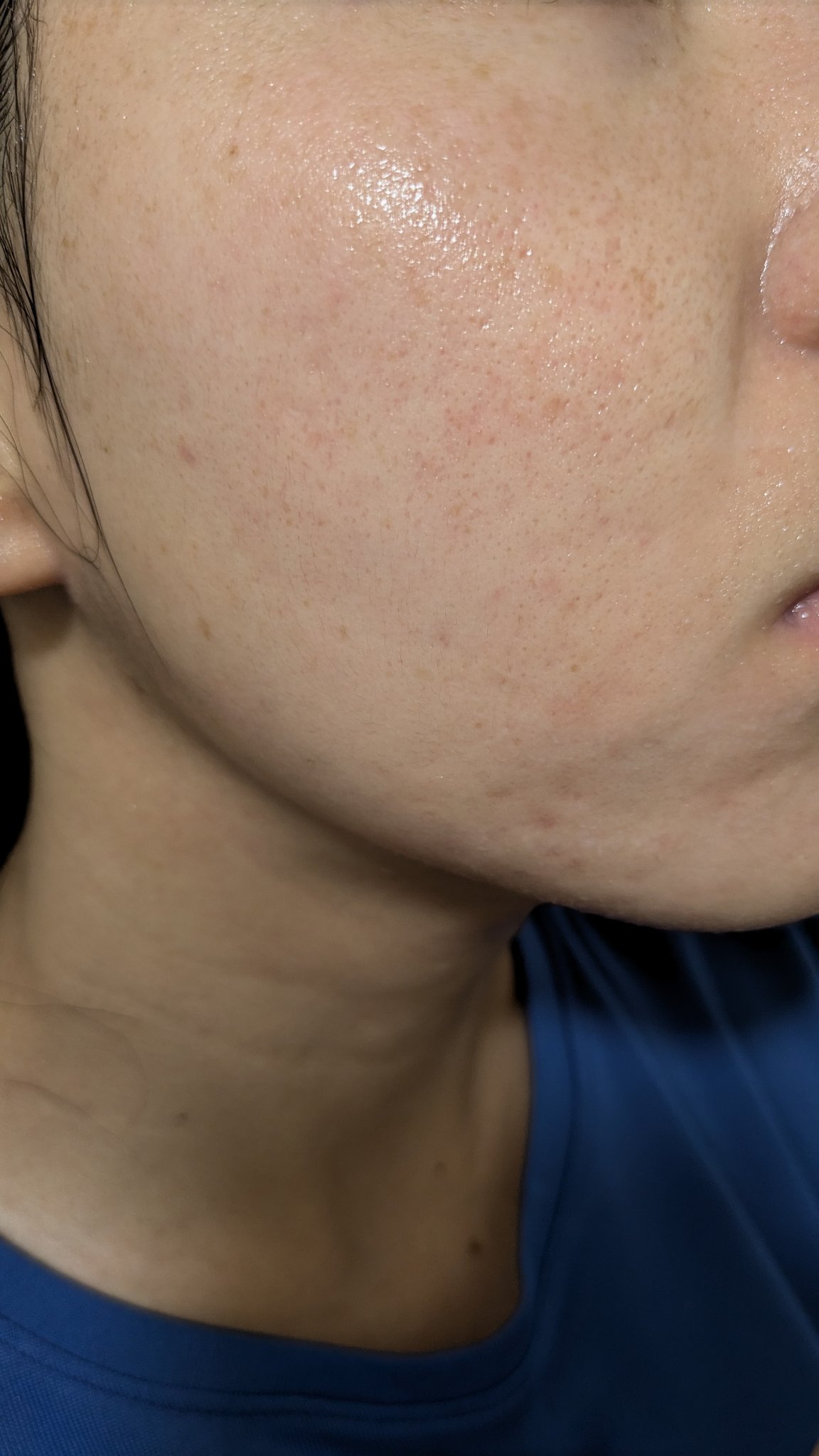 A2+NAG2ソリューション/The Ordinary/美容液を使ったクチコミ（1枚目）