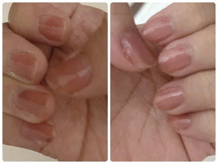 パル ピールオフベースジェル/キャンドゥ/ジェルネイルを使ったクチコミ(1枚目)