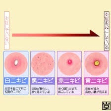 極潤 薬用ハリ化粧水【医薬部外品】/肌ラボ/化粧水を使ったクチコミ（1枚目）