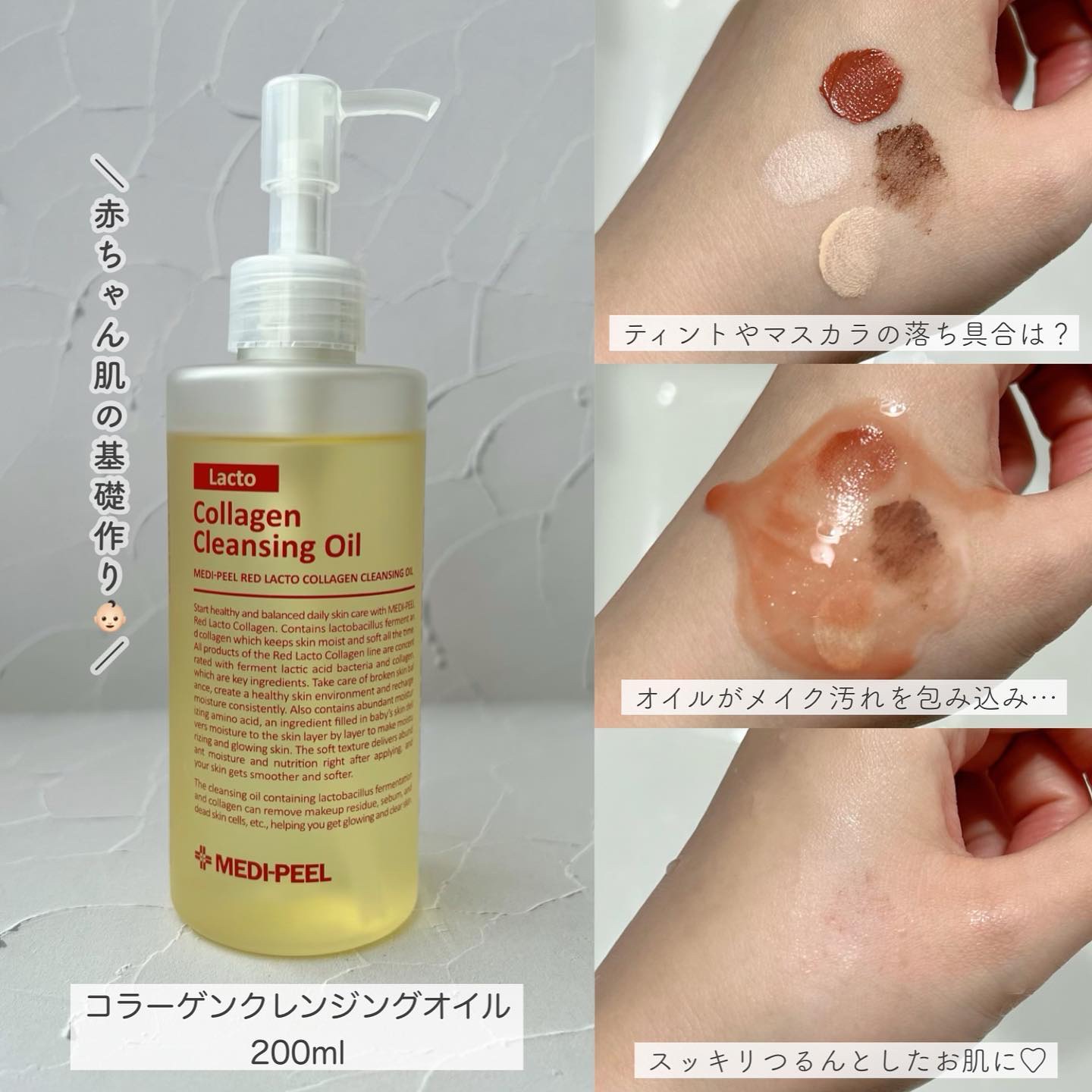 レッドラクトコラーゲンクリア2.0/MEDIPEEL/洗顔フォームを使ったクチコミ（2枚目）