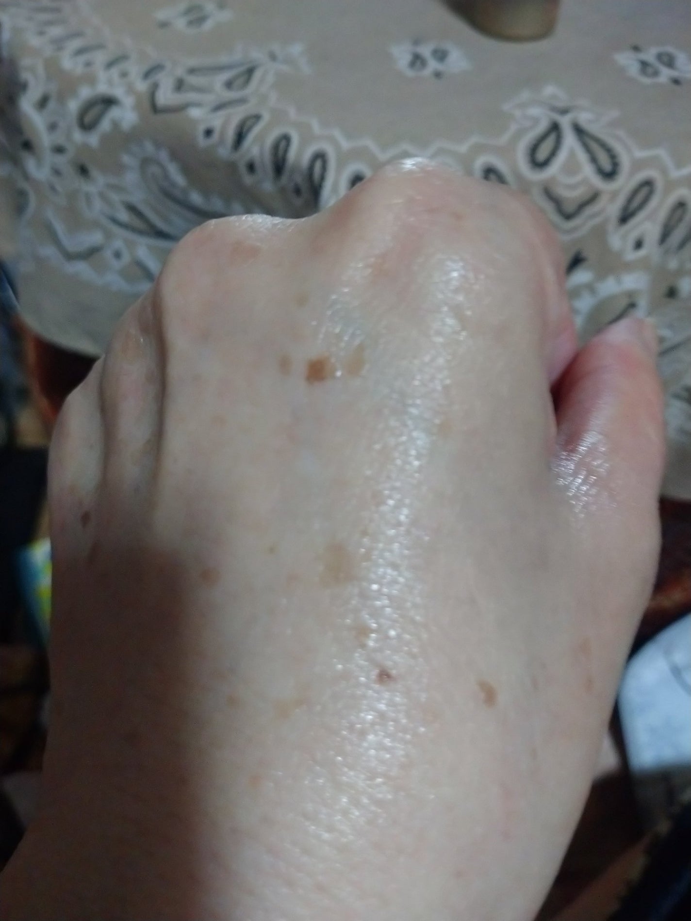 ブラックスネイルレチノールセラム/Dr.G/美容液を使ったクチコミ(3枚目)