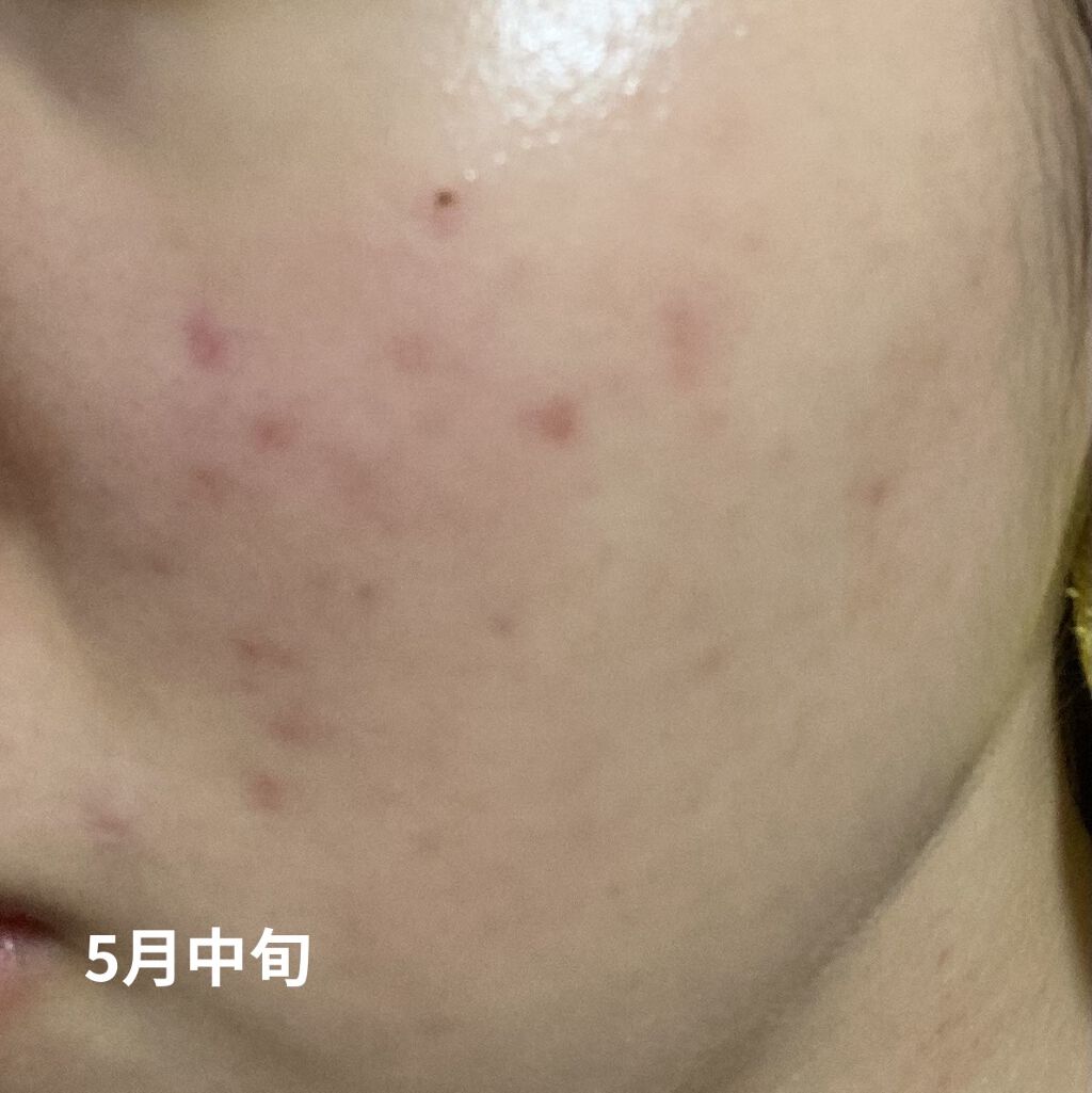 ビタミンC「2000」（医薬品）/武田薬品工業/健康サプリメントを使ったクチコミ（3枚目）