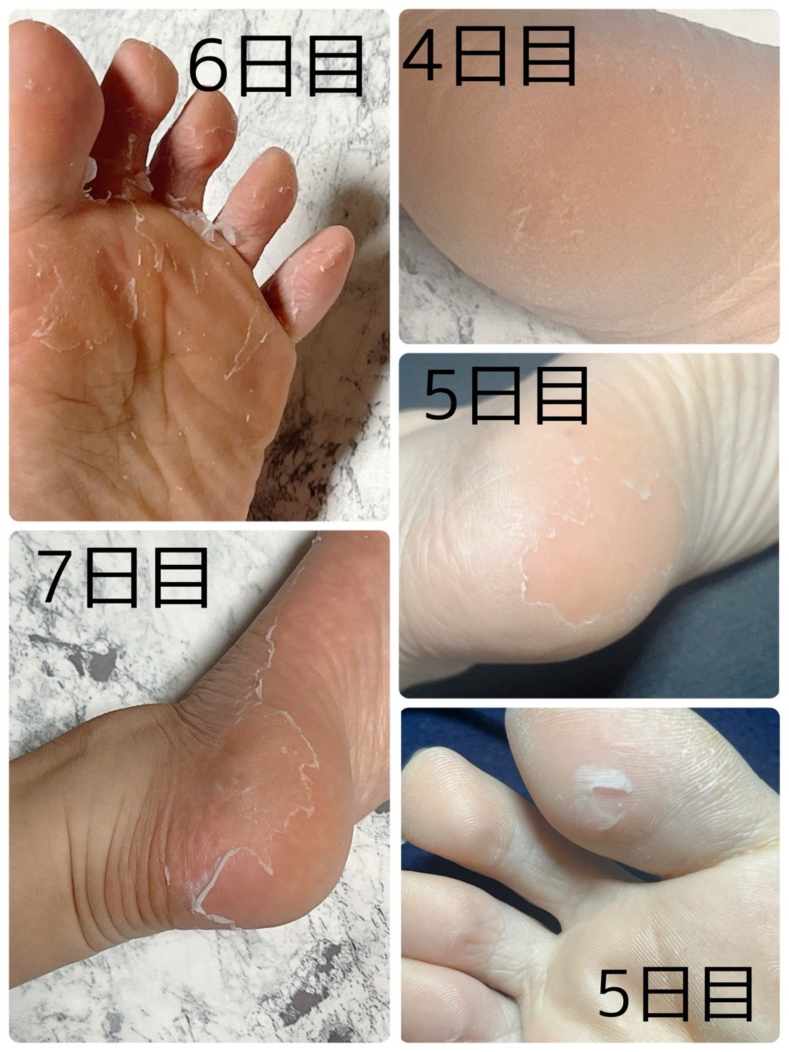 MYM 足裏ランラン エキスプレスのクチコミ「

はくだけ簡単、かかとツルツル！

足裏角質パック 

やってみたいと思いながらも
購入して.....」（3枚目）