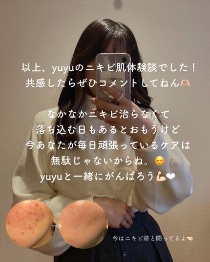 yuyuð¶èèãäœè³ªã®æ£çŽã¬ãã¥ãŒ on LIPS ããããèäœéšè«ð/âŒâ¢â¢âââ¢â¢âŒâ¢â¢âââ¢â¢âŒâ¢â¢âââ¢â¢âŒ..ãïŒ10æç®ïŒ