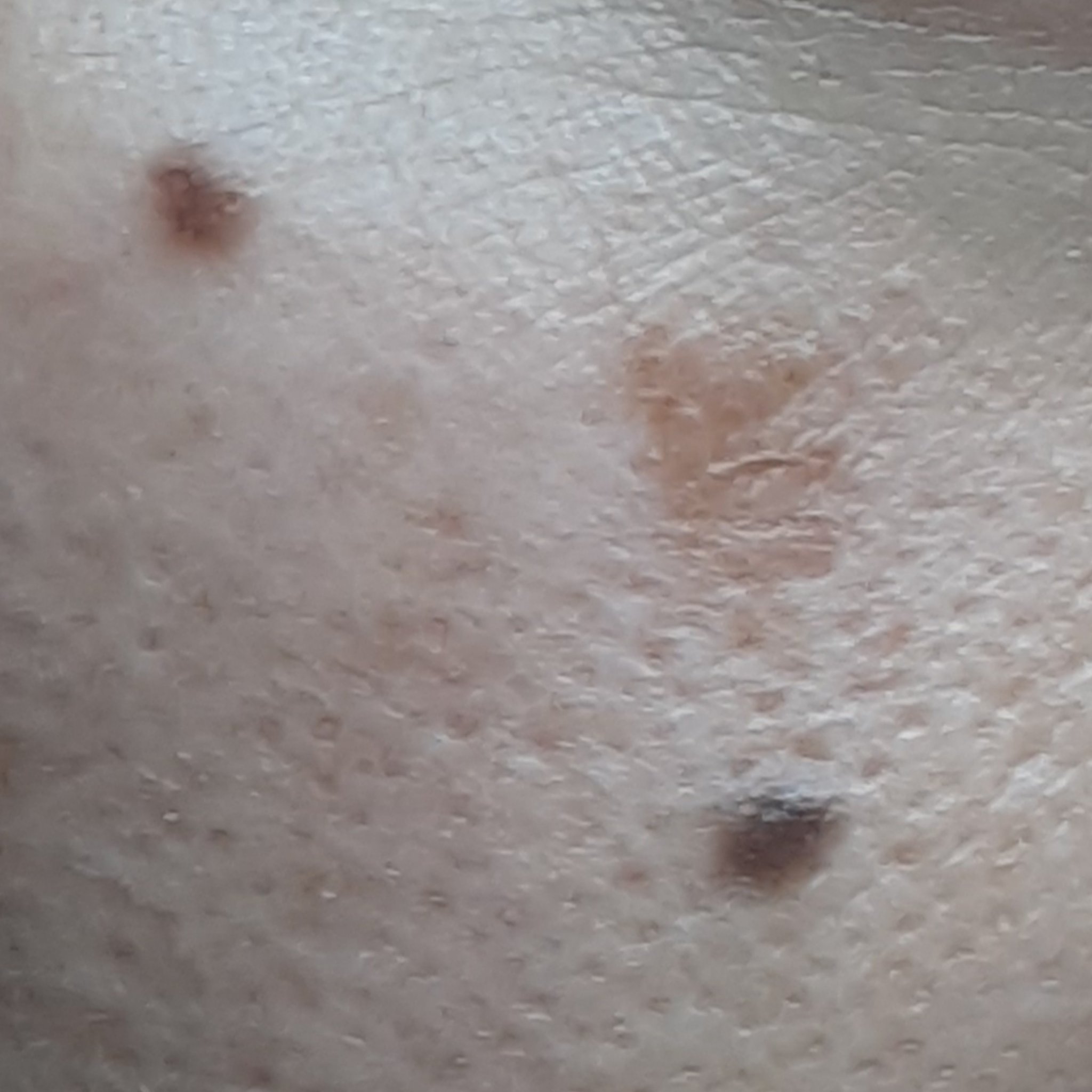 ハイドロクリームPHQ-8/KISO/美容液を使ったクチコミ（2枚目）