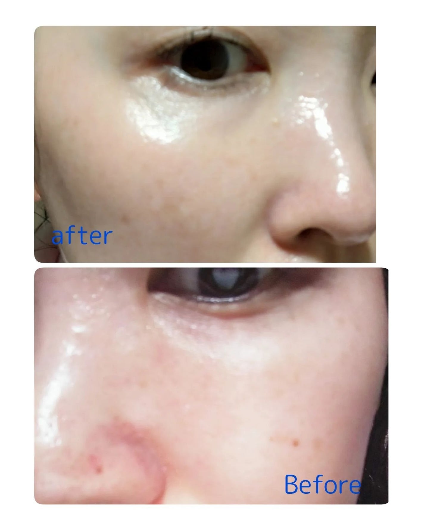 温感ブルーマスク/Torhop/洗い流すパック・マスクを使ったクチコミ(6枚目)