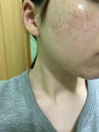 Glycolic Acid 7% Toning  Solution/The Ordinary/ブースター・導入液を使ったクチコミ（2枚目）