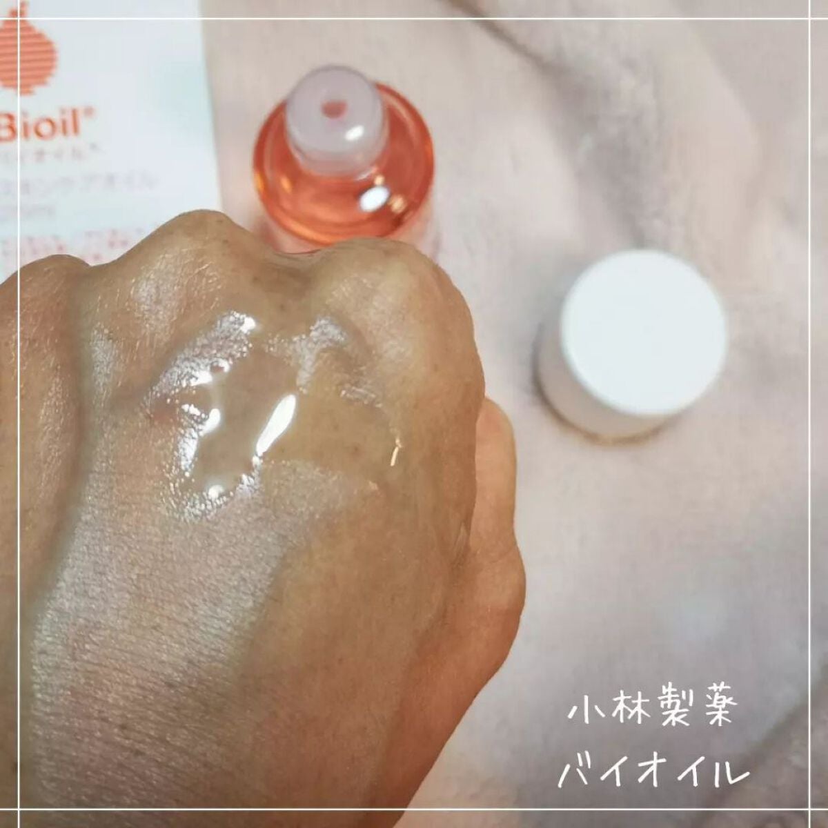 バイオイル/バイオイル/フェイスオイルを使ったクチコミ(3枚目)