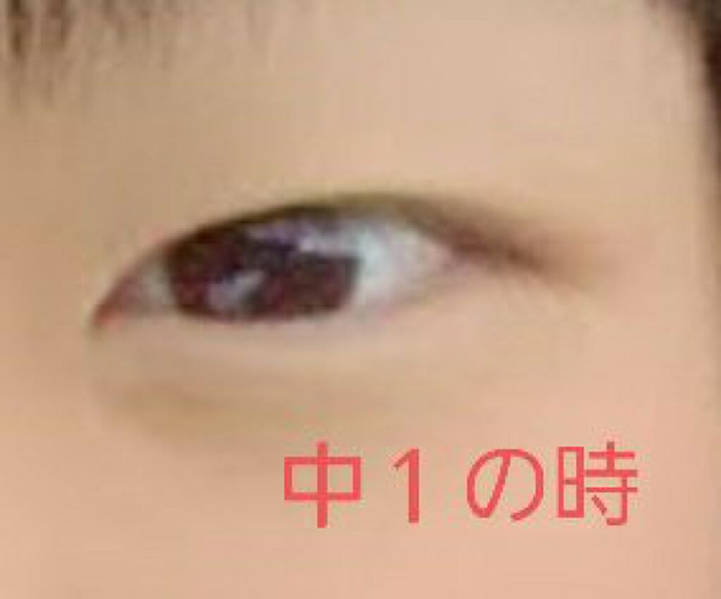 チョコラBBスパークリング/チョコラBB/美容ドリンクを使ったクチコミ（2枚目）