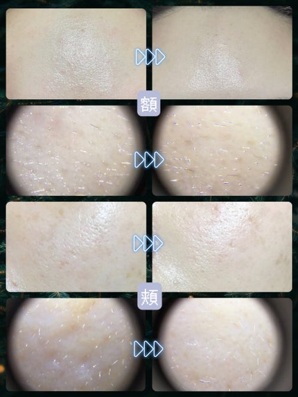 CICA デイリースージングマスク/VT/シートマスク・パックを使ったクチコミ(4枚目)