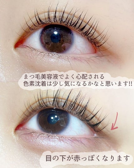 EMAKED(エマーキット)/水橋保寿堂製薬/まつげ美容液を使ったクチコミ(3枚目)